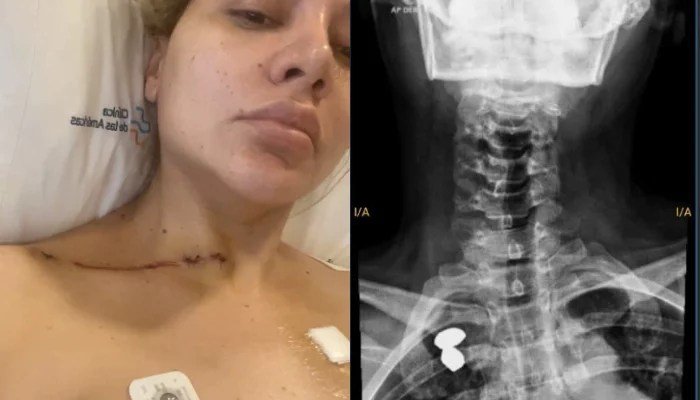 Nadia Beller Delgado after the shooting attack